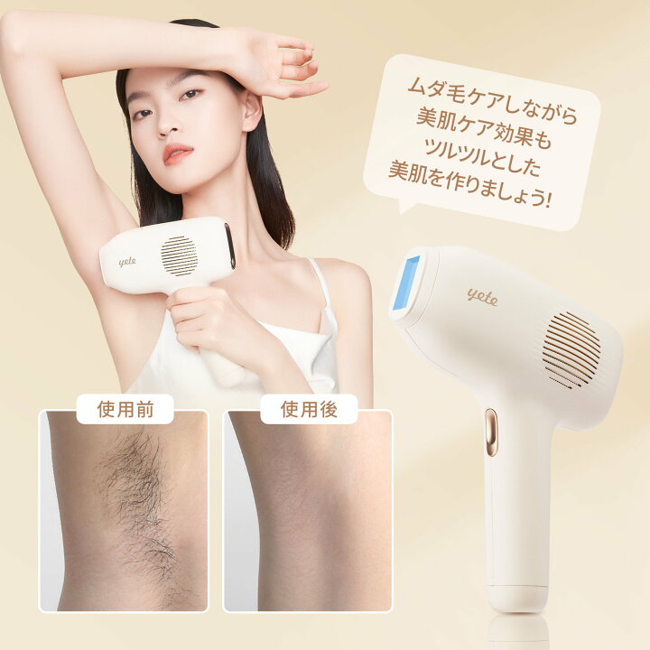 楽天市場】yete脱毛器 サファイア冷却技術 VIO 無痛脱毛 無限回照射 