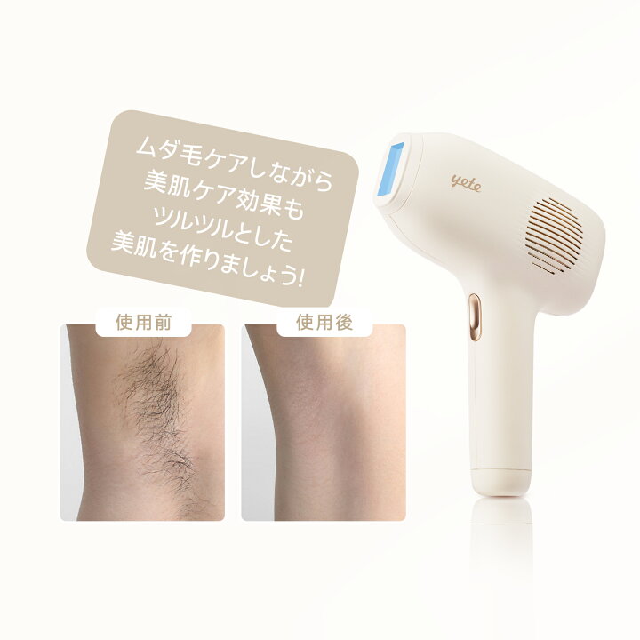 楽天市場】yete脱毛器 サファイア冷却技術 VIO 無痛脱毛 無限回照射 