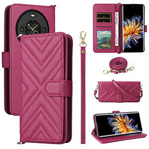 y20%OFFN[|zFOSSiBOT S3 Pro P[X ϏՌ Jo[ lpی Ռh~ TPU+PUU[ Xgbvz[t Ռɋ X}z یJo[ Xgbvt lC  蒠^P[X lC 