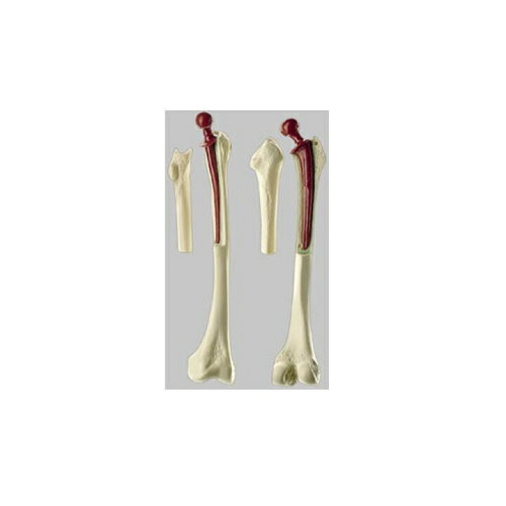楽天市場】模型Human Model 人工大腿骨模型 長さ31cm 170g QS71 ソムソ 