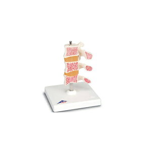 ͌^Human Model e頏ǃf 16cm A78 3B Scientific