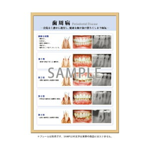 フレームアート 歯周病 453×604mm 1枚入 SmartPractice