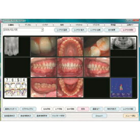 歯科用画像管理ソフトウェア ディンフォネスト3(LAN)アップグードLANユーザ用 1セット GC