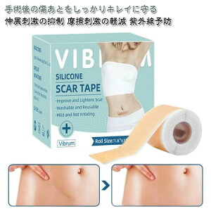 tatoo ʋC F B ^gD[ Ղ 鉤؊J e[v ƃPAe[v 4cm×300cm ƃPAe[v PCh