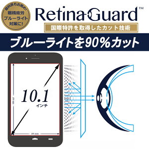 RetinaGuard t[Jbg 10.1C`(27 X c19 cm) u[Cg90%Jbg یtB ۓ tیtB یV[g یV[ Xperia Z4 Tablet dynabook arrows TabQH35/W TransBook T100 u[C