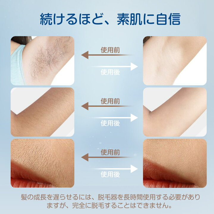 女性器　剛毛 楽天市場】【✨P10倍＋500円OFF】脱毛器 VIO 脱毛機 美肌 IPL光美容器 サロン級 髭 ヒゲ ムダ毛処理 フラッシュ シェーバー 除毛器  自動 連射 5段階レベル 冷感脱毛器 99万回数 レーザー 剛毛 女性 男性 フェイス 顔 髭 レディース メンズ 家庭用 母の日 1年保証 :  GMY ...