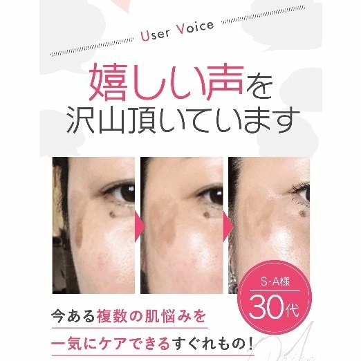 楽天市場】【ポイント5倍】 (最大) ヌービスセル 美容マスク
