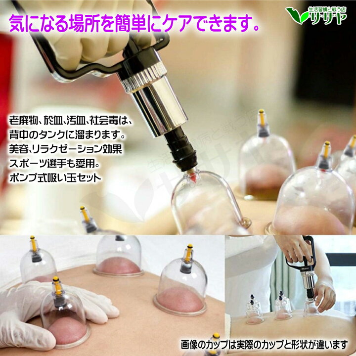 楽天市場 新発売価格 カッピング 吸い玉 本格プロ仕様ケース付き ガラス製 6個 ツボマップ プレゼント 鍼灸院 整骨院 送料無料 Rls Nbk Led パーツ アジアンモータース