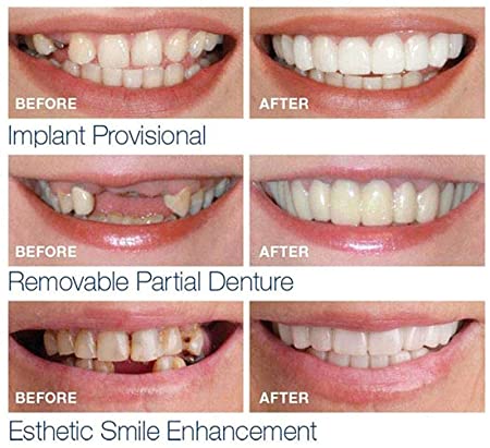 4ペア上部下部歯ベニア歯カバーオーラルホワイトニング歯科快適な笑顔偽歯カバー男性と女性のためのベニア