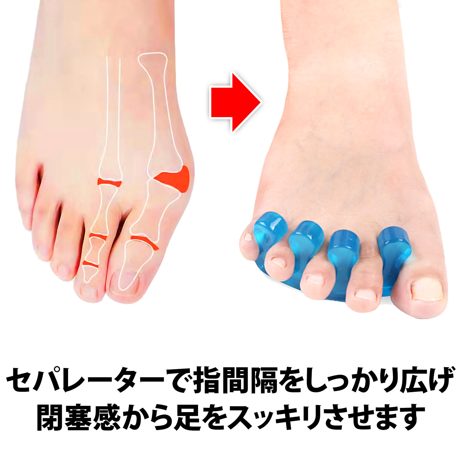 お得な特別割引価格） 足指セパレーター ブルー 2個 ネイル 外反母趾 足指パッド フットケア