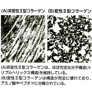 【正規販売店】非変性活性2型コラーゲンMC-IIEX(60カプセル){MC-2・UC−2・MC2・UC2・UC・2・UC・II・MCー2・MC-II・MC-2EX・MC2EX・MC・2EX}非変性活性II型コラーゲン非変性2型コラーゲン!【送料無料】
