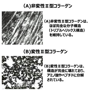 【販売元直販】非変性活性2型コラーゲン『UC-IIエクセレント(60粒)』{UC−2UC2UC・2UC・IIUC-2UC−〓UC〓MC2MCー2MC-IIMC-2EXMC2EXMC・2EX}非変性2型コラーゲン非変性活性II型コラーゲン非変性II型コラーゲンサプリMC-2EX改良版【送料無料】