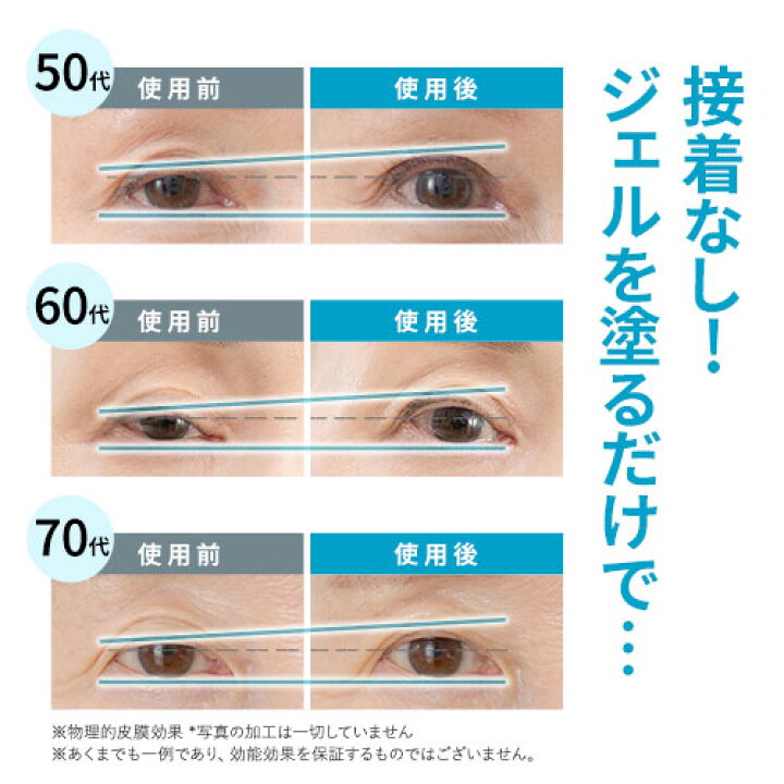 楽天市場】【公式】まぶた 引き上げ ジェル 北の快適工房 