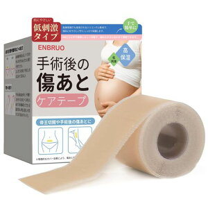 ENBRUO鉤؊JPChpVRe[v|hx̒ɂ݌yYPAፍՕی삩ݖh~qΉOJbg(F4CM*150CM)