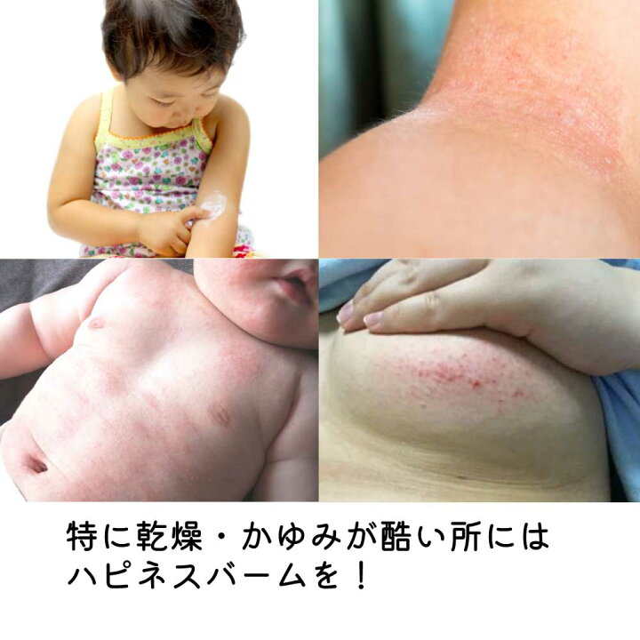 赤ちゃん　股間 