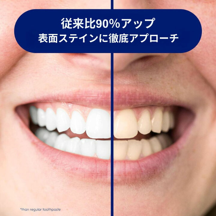 楽天市場】【2本セット】最新版 Crest 3D White Advanced Radiant Mint 3本 Crest クレスト 3D White Radiant Mint 歯磨き粉