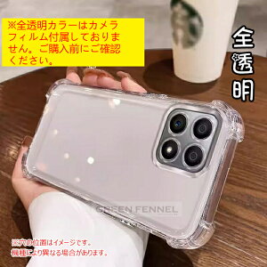 �u�V�i�I�t�B�����Z�b�g�vxiaomi17ultra xiaomi 17 ultra Leica �P�[�X �N���A ���� Xiaomi 15t pro Xiaomi15TPro �J�o�[ �ϏՌ� �J�����t�B������� �ی�P�[�X �V���I�~15t �v�� �ی�J�o�[ xiaomi15t Xiaomi 15ultra 1