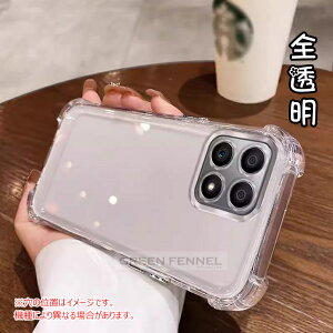 �u�V�i�I�t�B�����Z�b�g�vXiaomi 15t pro �P�[�X �N���A ���� Xiaomi15TPro �J�o�[ �ϏՌ� �J�����t�B������� �ی�P�[�X �V���I�~15t �v�� �ی�J�o�[ xiaomi15t�P�[�X Xiaomi 15 t 15ultra 14t 14tpro 14ultra 13t 