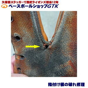 O[u̎wҕt߂̔jɏC܂ C20NI[o[ GTK