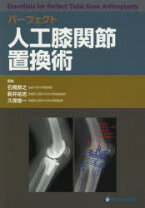 楽天市場】人工膝関節全置換術[tka]のすべての通販