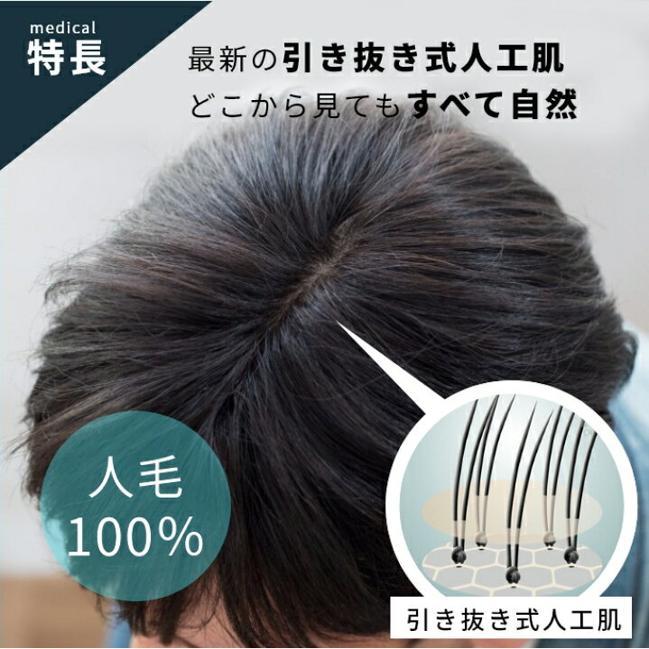 楽天市場】ヘアダイレクト 生え際が出せる男性医療用かつら（全頭  