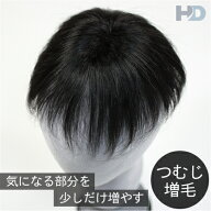 【つむじ増毛製品Mサイズ・自然色】★送料無料☆ヘアダイレクト★最高級人毛100％です！☆総手植え＆100…