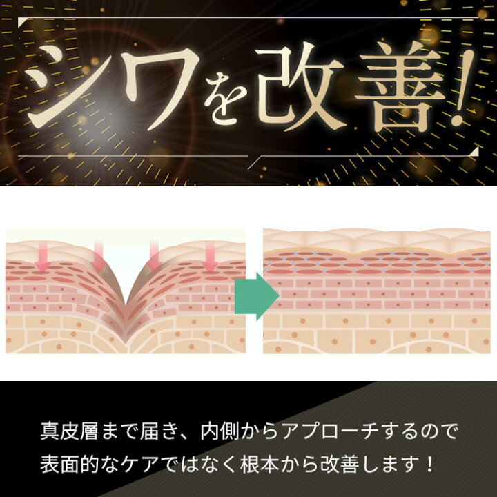 楽天市場】シミ予防 しわ シワ改善 薬用シミシワ ホワイト クリーム 