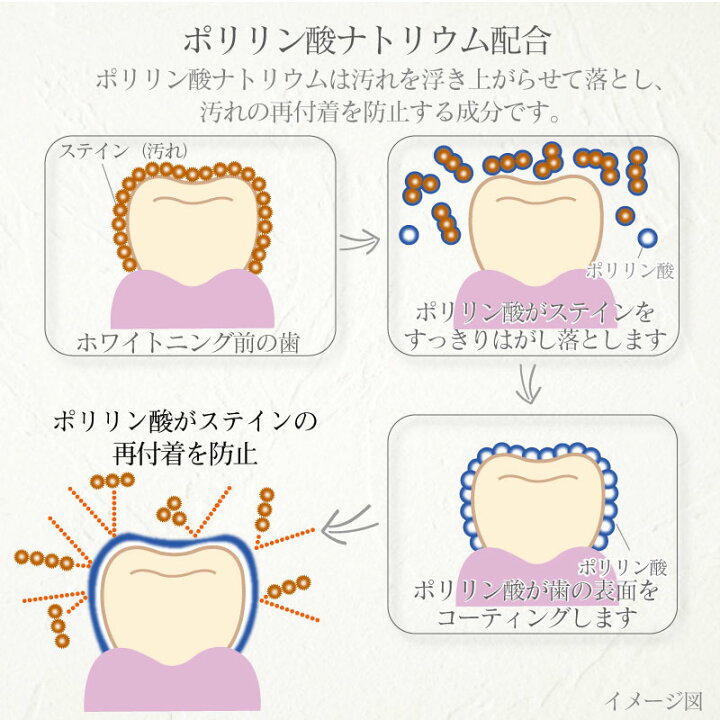 楽天市場 ペルデンティ 薬用ハミガキ 歯科専用 ホワイトニング フッ素配合 歯磨き粉 ポリリン酸ナトリウム キシリトール配合 85g 1本入 オススメの歯ブラシ ハノケア 楽天市場 ペルデンティ 薬用ハミガキ 歯科専用 ホワイトニング フッ素配合 歯磨き粉 ポリリン酸ナトリウム キシリトール配合 85g 1本入 オススメの歯ブラシ ハノケア