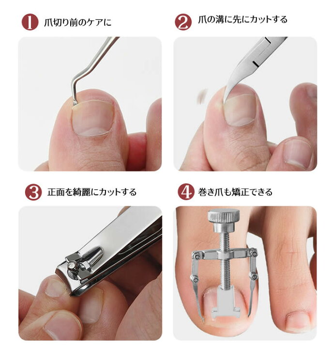 2021年ファッション福袋 フットケア ゾンデ 巻き爪 爪ケア フットケア ゾンデ 巻き爪 爪ケア