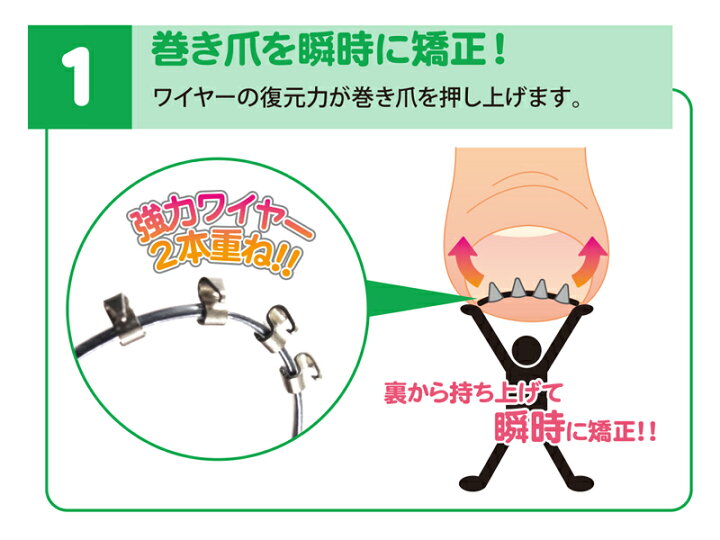 楽天市場】まきづめリフト 巻き爪 矯正 補正 まきづめ ケア 矯正器 
