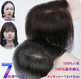 返品交換OK 人毛100% 部分ウィッグ 頭頂部 前髪ウィッグ 人毛 ウィッグ 総手植え ポイントウィッグ 医療用 薄毛 増毛 部分かつら 自然 白髪かくし つけ毛 トップカバー つむじ付き リアル ナチュラル