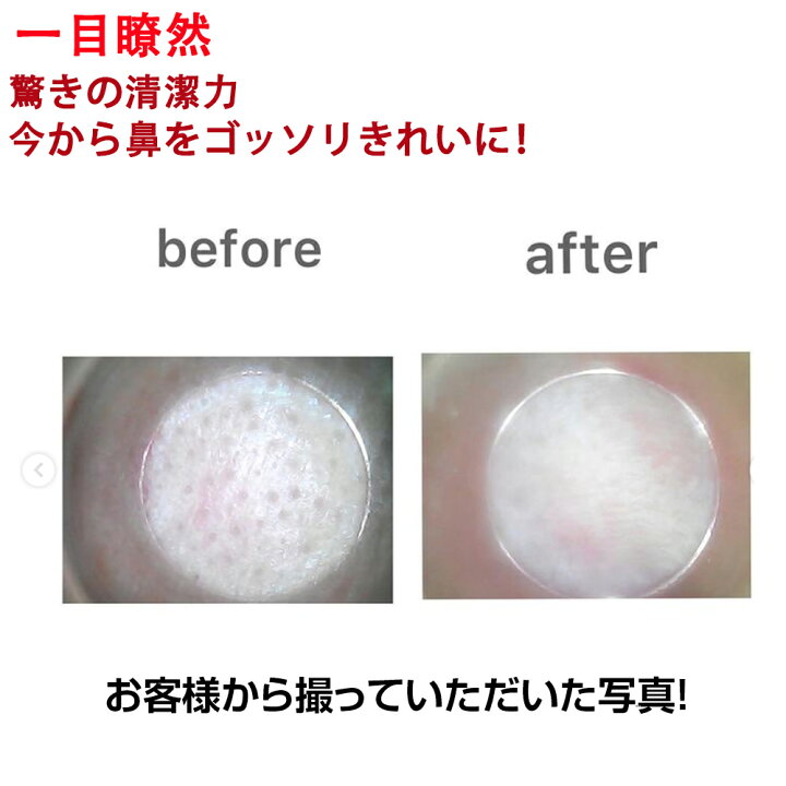 楽天市場 倍毛穴画面拡大 毛穴 吸引器 毛穴吸引器 毛穴吸引 毛穴吸引機 毛穴ケア 毛穴クリーナー黒ずみ吸出し 黒ずみケア 黒ずみ 除去 角栓取り 角栓 毛穴汚れ 毛穴 洗顔 いちご鼻 引き締め 吸引 コードレス 黒ずみケア 30万画素 専用アプリ付き 日本語説明書