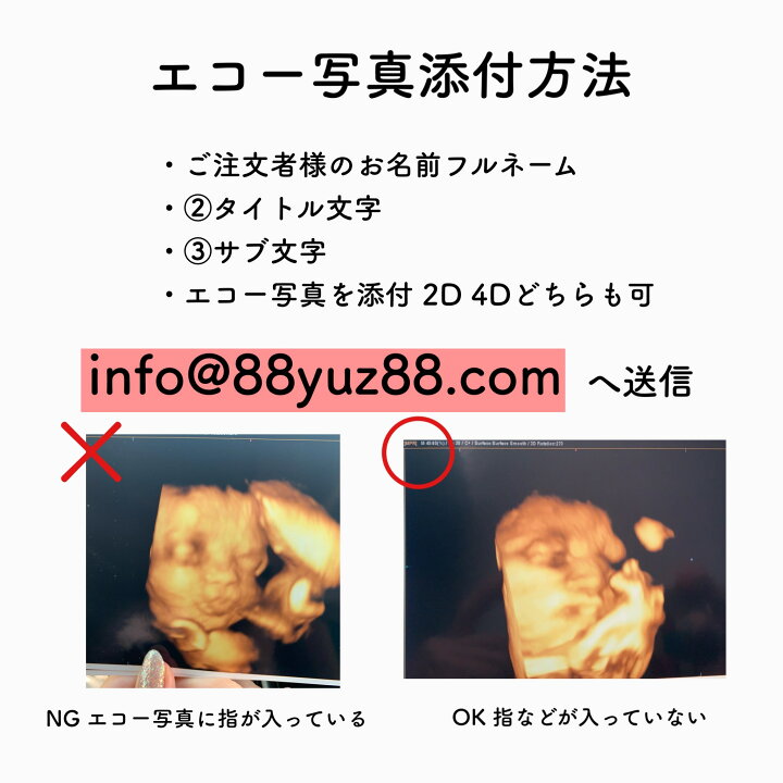 楽天市場】エコー写真 エコー オーダー シンプル マタニティシール 