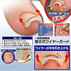 【ポイント15倍】 巻き爪ワイヤーガード 一般医療機器 巻き爪ガード 形状記憶ワイヤー