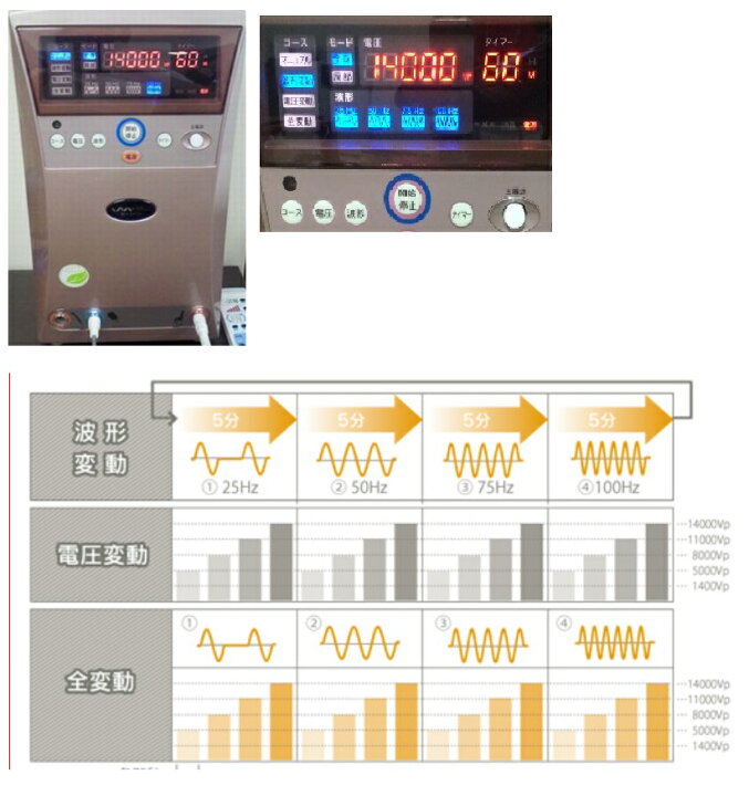 楽天市場】インプレックス イアス30000 5年保証【送料無料】 IMPREX 
