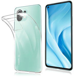 �y���������z�P�[�X �J�o�[ �N���A TPU�����ی� �\�t�g �V���R���P�[�X ���^ �����h�~ �Ռ��z�� �ϏՌ� �_�炩����G�� �N���A �S�ʕی�J�o�[ PCduoduo �F�FFOR Xiaomi Mi 11 Lite 5G TPU�A�T�C�Y�FFOR X