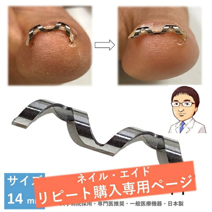 楽天市場 追加購入専用 14mm 巻き爪 自分で 巻き爪矯正 ネイル エイド クリップ ワイヤー ガード 爪ブロック 切り方 テープ ロボ 巻きづめ 靴 巻爪 対策 14mm ピンセット説明書なし クーポンで100円割引 巻き爪 陥入爪治療の相談室