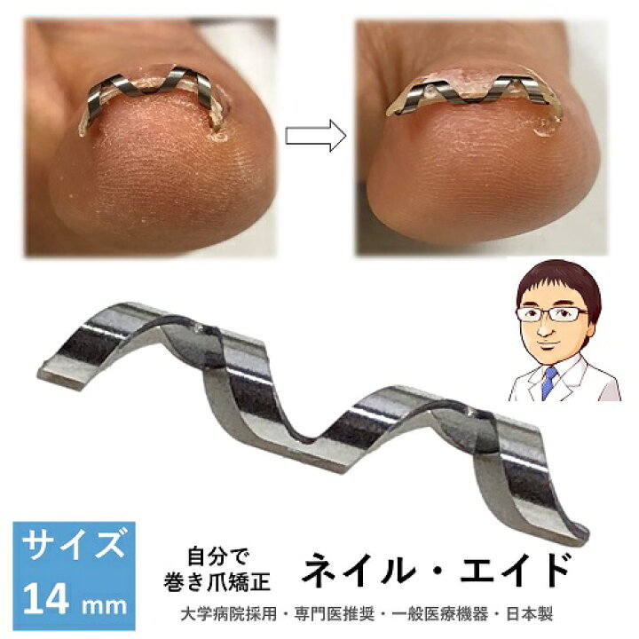 楽天市場】巻き爪 自分で 巻き爪矯正 【 ネイル・エイド 14mm 
