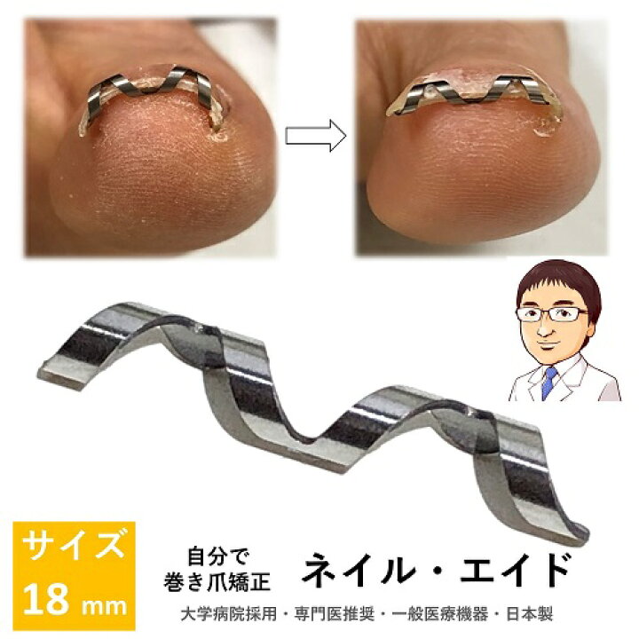 楽天市場 巻き爪 治療 自分で 矯正 ネイル エイド 18mm クリップ ワイヤー ガード 爪ブロック リフト テープ ロボ 巻きづめ 巻爪 介護 18mm 巻き爪 陥入爪治療の相談室