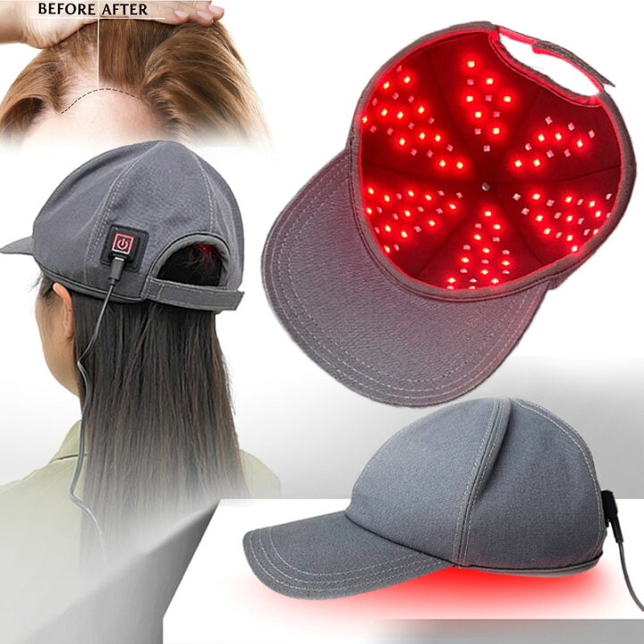 楽天市場】育毛キャップ 赤色 led 育毛 110pcsランプビーズ 赤色光  