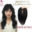 【試着可能 返品OK】 部分 ウィッグ かつら 人毛100% 完全手作業 リアル 人工皮膚 自然 ヘアピース 人毛 医療用 頭頂…