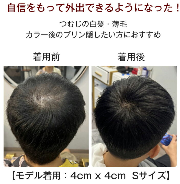 楽天市場】返品OK 部分 ウィッグ 人毛 100% 頭頂部 つむじ ショート 
