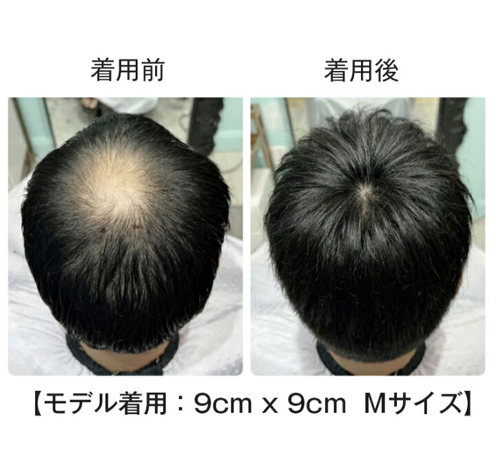 楽天市場】【試着可能 返品OK】 部分 ウィッグ 人毛 100% 頭頂部 