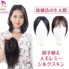 【試着可能 返品OK】普段着の決定版 8×12cm 部分 ポイント ウィッグ 総手植え 頭頂部 人毛 100% レミーヘアー トップ 分け目 白髪隠し ヘアーピース 自然 人工肌 目立たない 薄毛 円形脱毛 つむじ カバー 前髪 通気性 つけ毛 増毛 女性 軽量 新構造の生え際