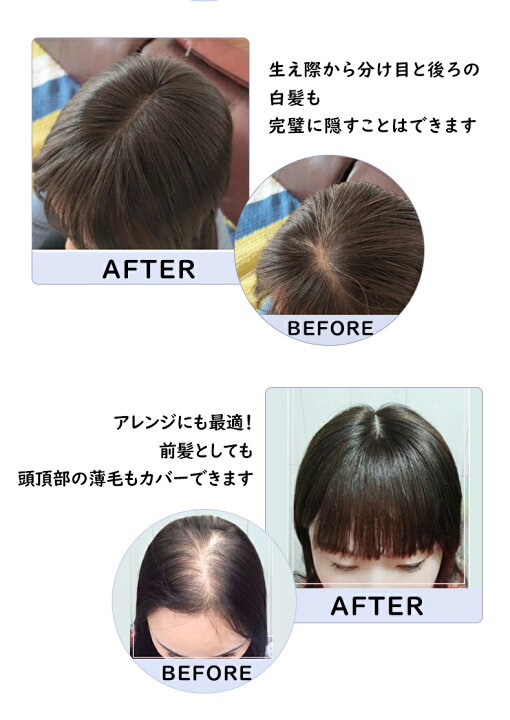 楽天市場 人毛100 部分ウィッグ ヘアピース 自然 つむじ 分け目自由 総手植え 前髪 頭頂部 前髪ウィッグ 白髪隠し 薄毛 抜毛症 脱毛症 ポイントウィッグ 医療用 部分かつら 女性 ぶぶんかつら Hiye 送料無料 Jq715hl 15 部分ウィッグ7 14 楽天海外通販 Hiye