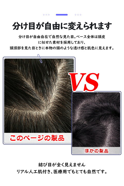 楽天市場 ウィッグ部分 つむじ 人毛100 医療用 つむじ 部分 ヘアピース かつら 女性 メンズ 手植え 白髪隠れ 前髪ウィッグ 自然 部分ウィッグ7 10 楽天海外通販 Hiye ウィッグ専門店