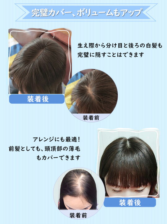 楽天市場 ウィッグ部分 ヘアピース 人毛100 総手植え 自然 人工皮膚加工 通気 ショート 部分ウィッグ 超リアル つむじ 前髪付き トップ カバー 医療用 白髪 薄毛 脱毛隠し ボリュームアップ メンズ かわいい 女性 送料無料 部分ウィッグ8 12 楽天海外通販 Hiye