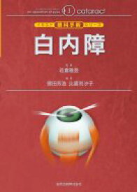 楽天市場 白内障 イラスト眼科手術シリーズの通販