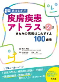 患者説明用 皮膚疾患アトラス 第2版 あなたの病気はこれですよ100疾患 / 松下貴史 【本】