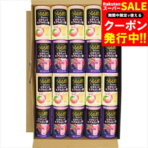 Ε W[X Mtg  HׂÔ|r[eB[2lZbg(UB-30) / Ε ~Mtg j Ԃ Ԃ j ݕ W[XMtg W[XZbg oGeB 